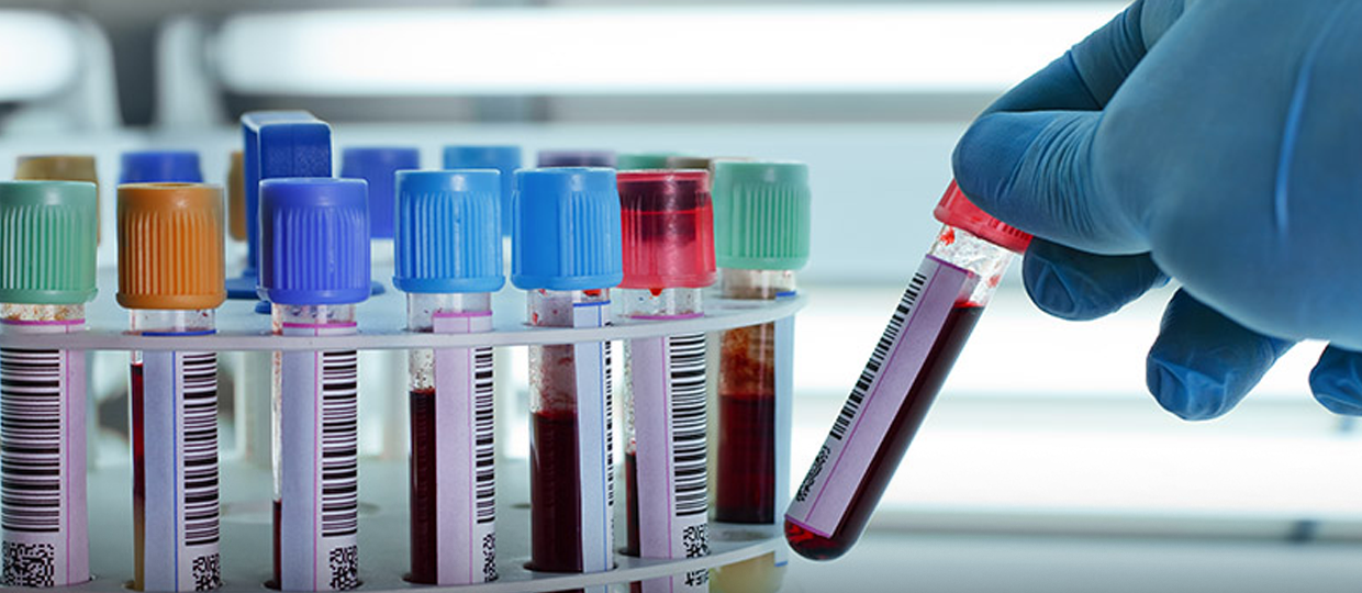 Novembro Azul: FIB e Biolab oferecerão exame de sangue gratuito para bauruenses